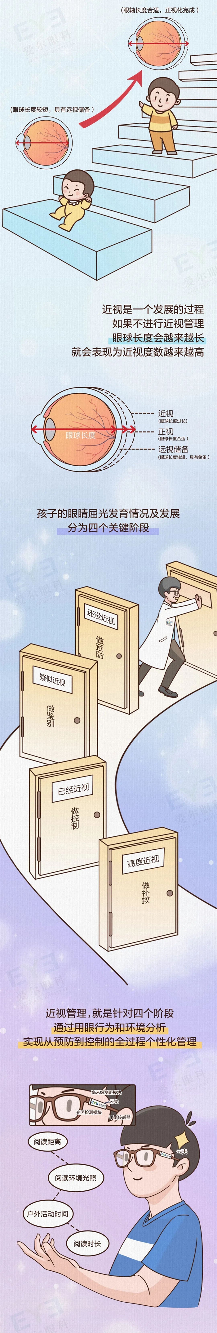 近视发展阶段示意图2
