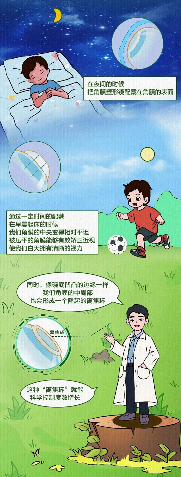 角膜塑形镜工作原理示意图