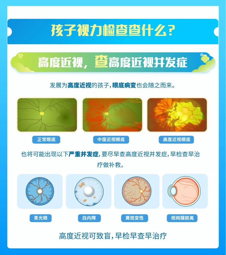 高度近视并发症示意图
