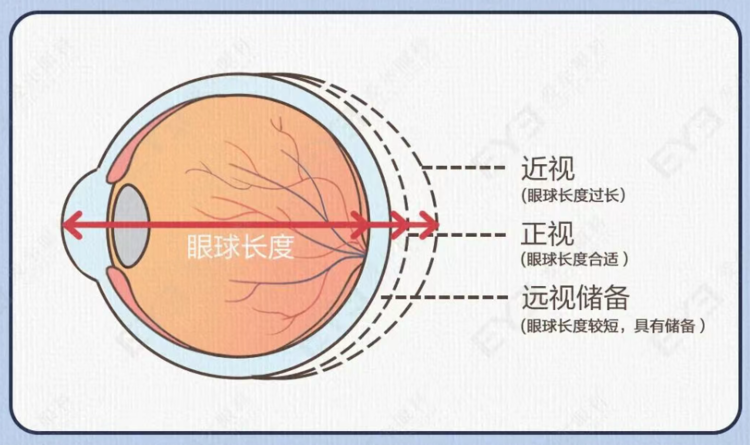 近视防控科普示意图