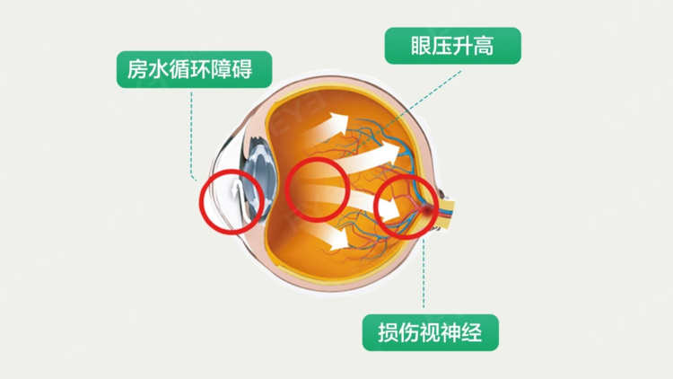 远视储备科普插画：眼睛里的银行存着远视储备宝藏